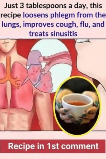 A homemade natural syrup packed with onion, garlic, ginger, lemon, carrot, and honey to support immune and respiratory health.