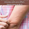 My Nana’s Mosquito Bite Trick – Soothe Those Itches in 2 Minutes!