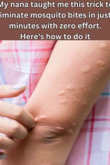 My Nana’s Mosquito Bite Trick – Soothe Those Itches in 2 Minutes!