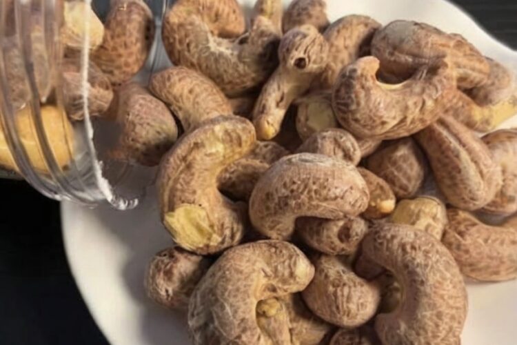 Doctors Reveal What Happens When You Eat Cashews: Benefits for Heart, Metabolism, Skin & More