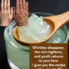 Home Remedies for Mouth Wrinkles