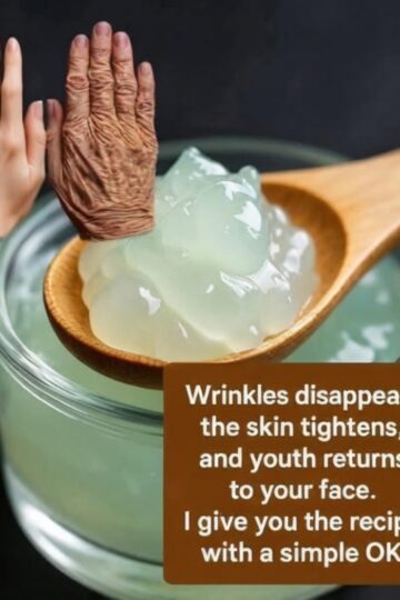 Home Remedies for Mouth Wrinkles